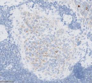 Haloを用いた解析例_解析前