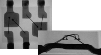 X線観察で異常なし