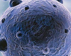 Tackling Global Antibiotic Resistance