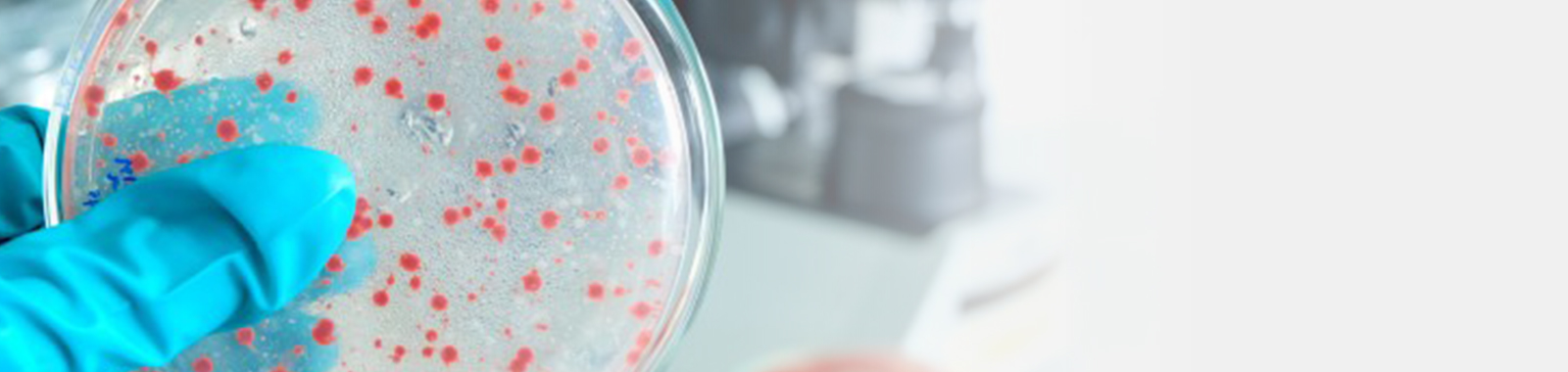 Specialised Antimicrobial Efficacy Test Method & Preservative Testing