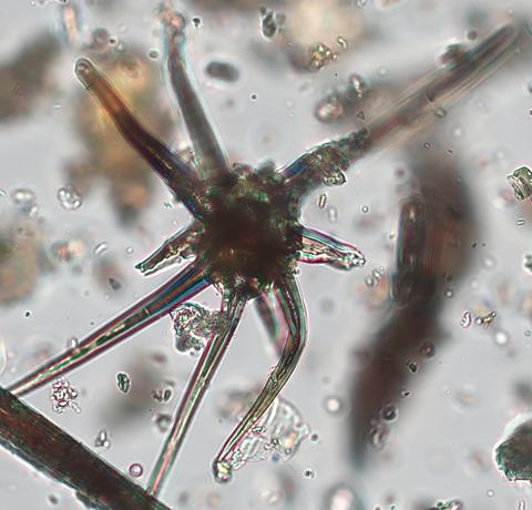 Cistus trichome