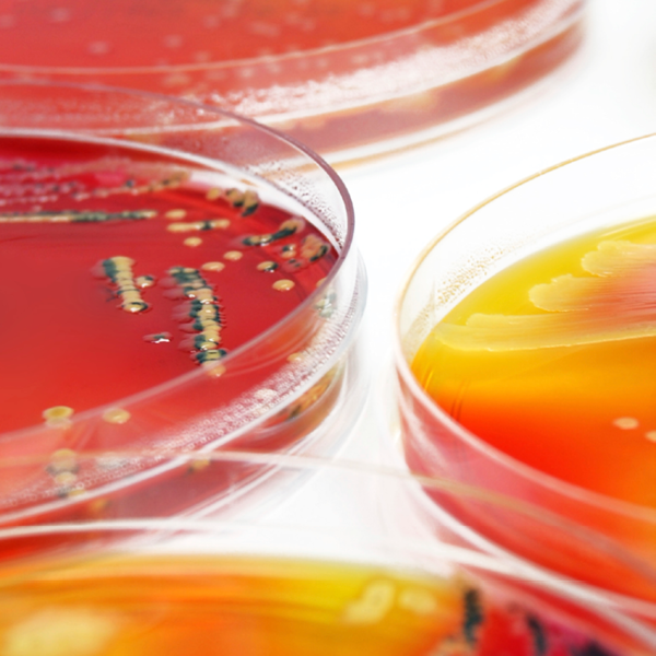 Mikrobiologi for kvalitetsavdelingen